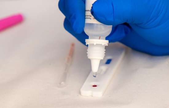 Campanha Fique Sabendo 2024 oferece testagem gratuita de HIV e sífilis ...