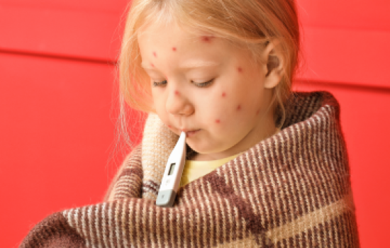 Sarampo cresce 32 vezes nas Américas em um ano; veja situação do Brasil